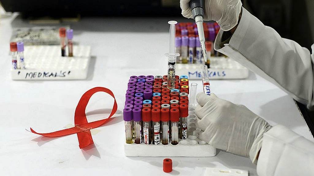Menos da metade dos infectados por HIV e tuberculose tomam antirretroviral