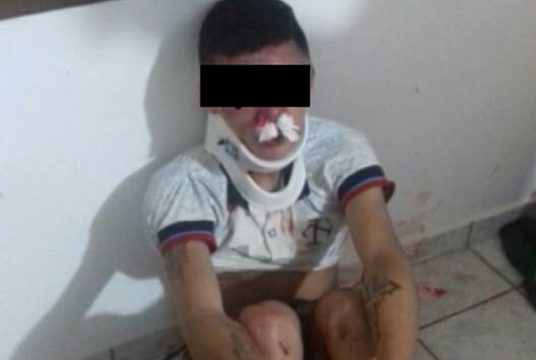 Balneário Barra do Sul | Adolescente é amarrado após cair de escada durante tentativa de assalto