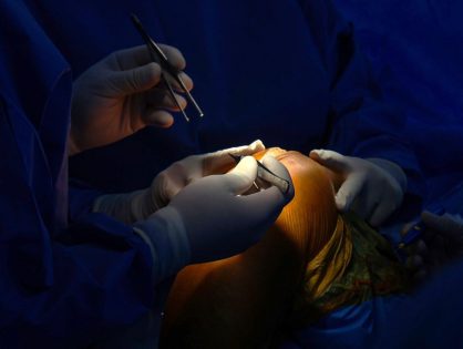 Governo do Estado aprova habilitação em ortopedia para o Hospital São José de Maravilha