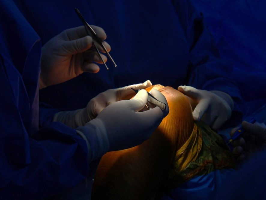 Governo do Estado aprova habilitação em ortopedia para o Hospital São José de Maravilha